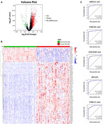 High Expression of Long Non-Coding RNA TMCO1-AS1 is Associated With Poor Prognosis of Hepatocellular Carcinoma